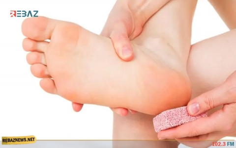  4 نصائح هامة لتجنب تشقق الكعبين هذا الشتاء