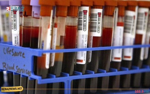 دراسة تكشف فصيلة الدم الأكثر مقاومة لكورونا